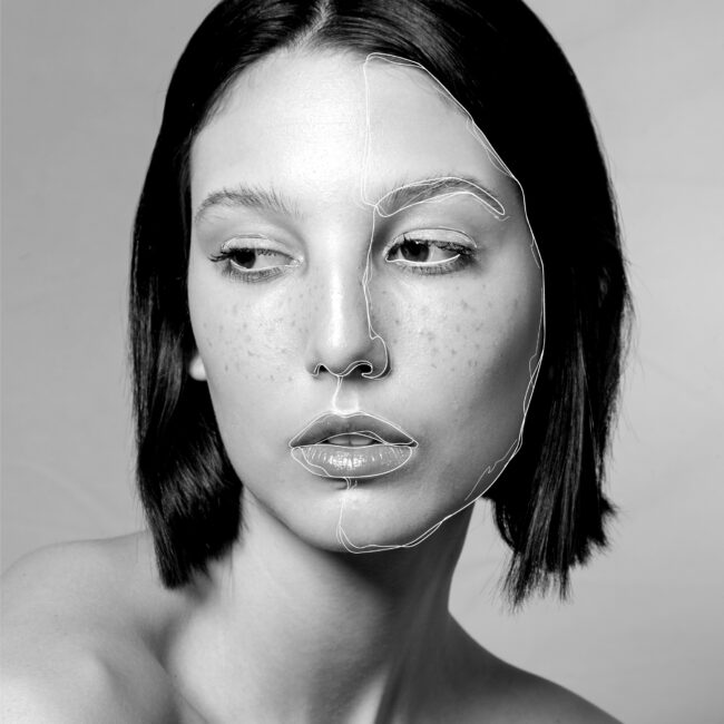 Химичен пилинг